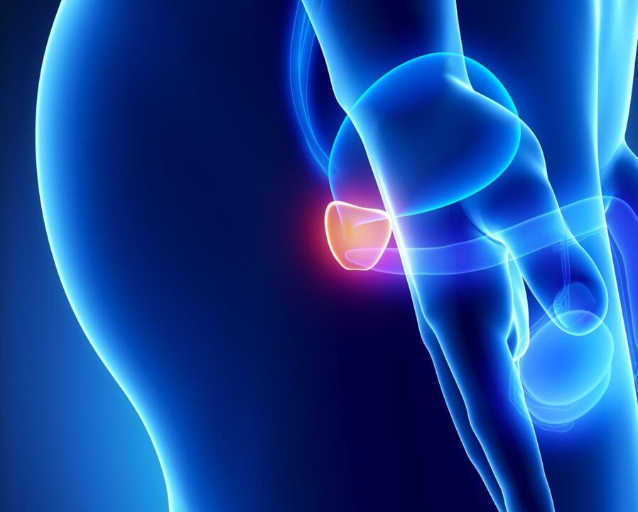 Inflammation of the prostate